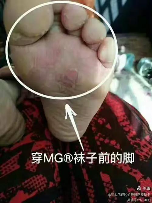 投资制袜厂要花多少钱?-图3 投资制袜厂要花多少钱?-图3