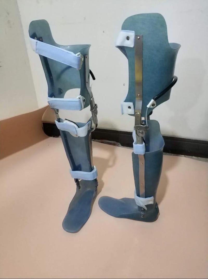 山西运城骨科矫形医院有何特色？-图2